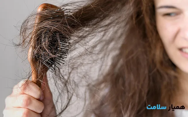 کم خونی و ریزش مو1