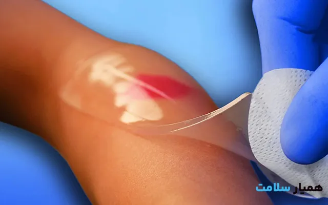 پانسمان نوین در منزل4